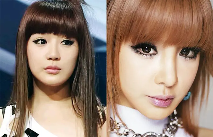 The image of Park Bom (2NE1)